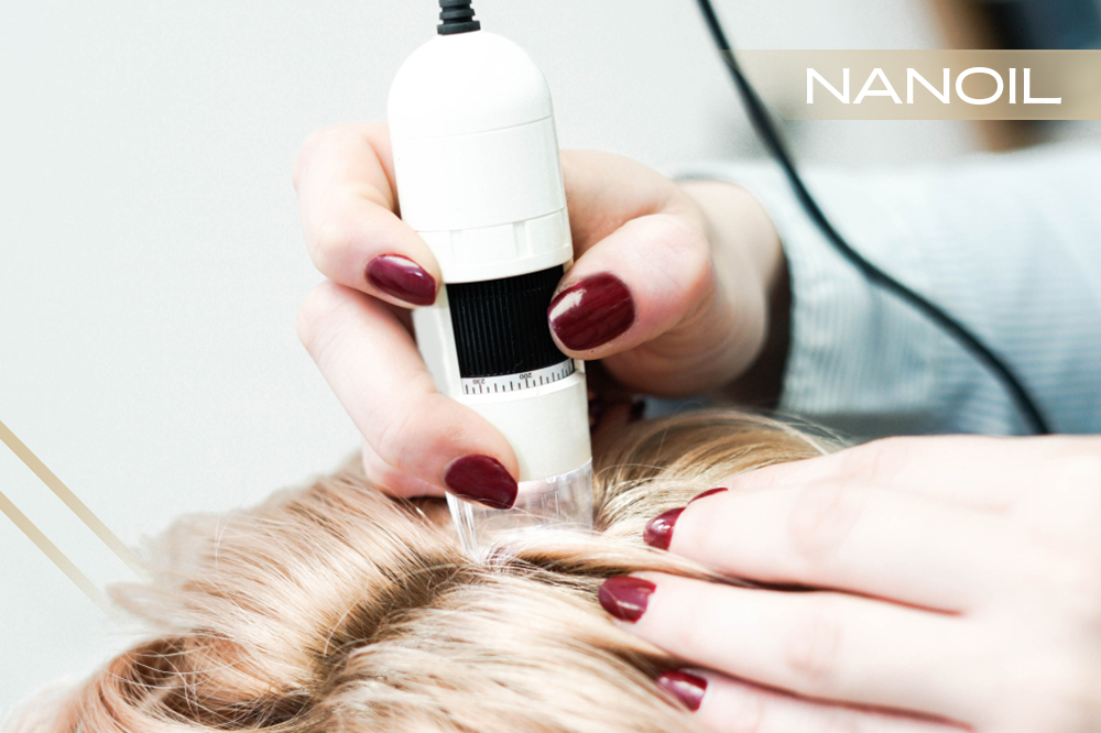 Welche Kopfhautkrankheiten gibt es? Ursachen und Typen